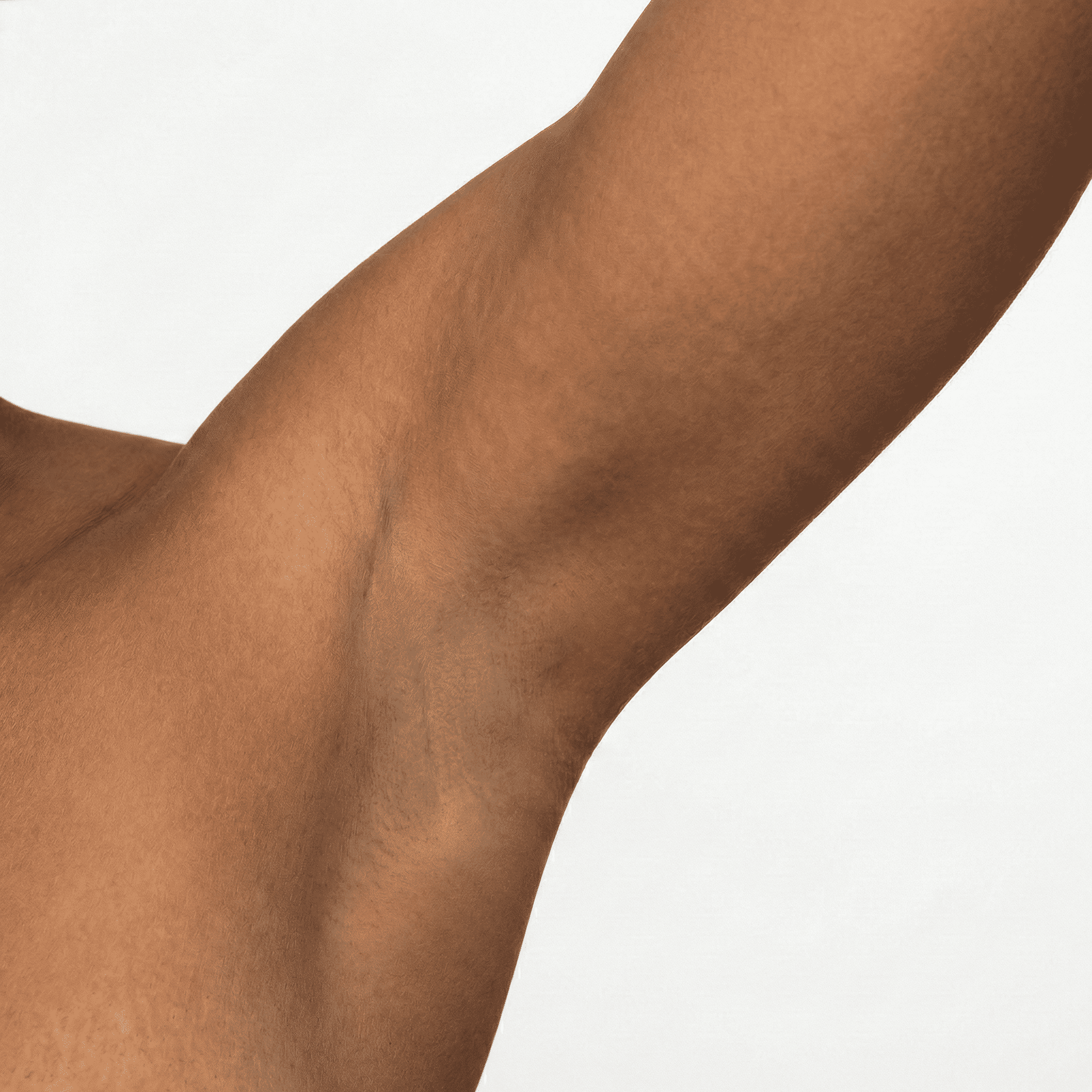 Depois do tratamento