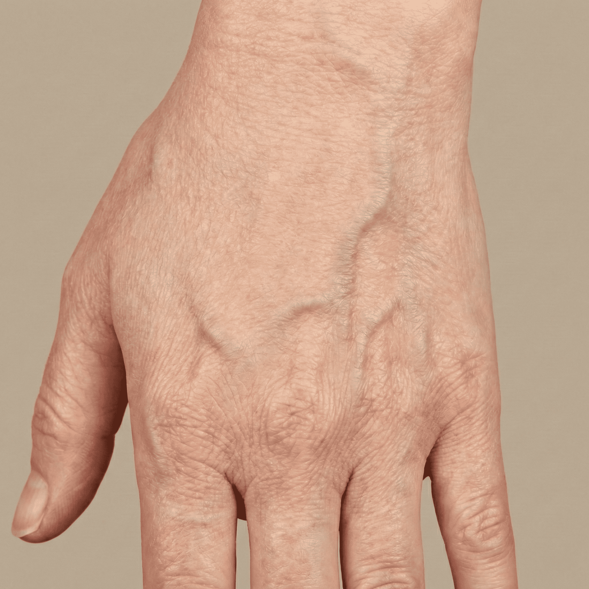 Depois do tratamento